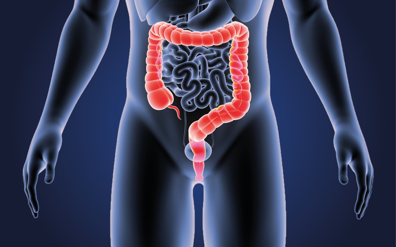 Diagram showing a man's internal organs with the emphasis on the digestive system and particularly the bowel which is highlighted in red