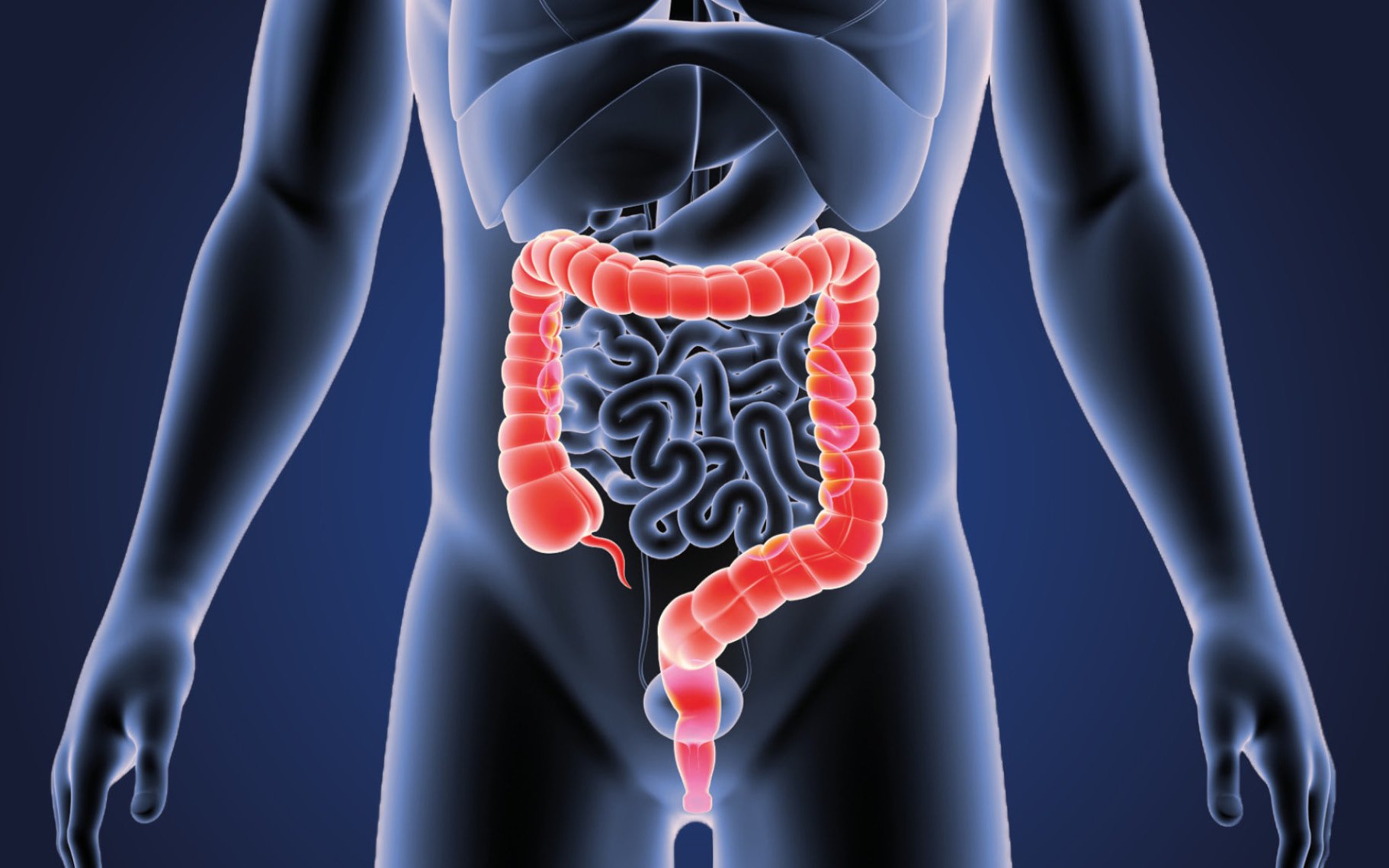 Medical digram showing a man's internal organs, particularly the bowel