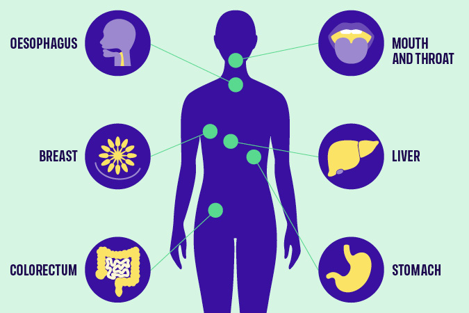 Infographic of the body showing the cancer sites linked with alcohol