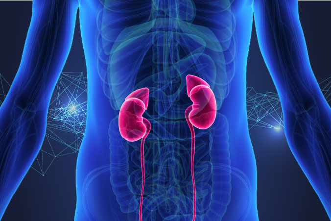 Anatomical diagram of kidney cancer