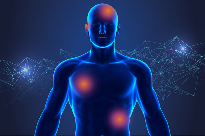 Anatomical graphic of skin cancer