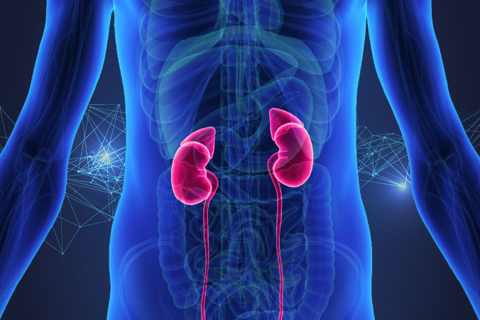 Anatomical graphic of kidney cancer