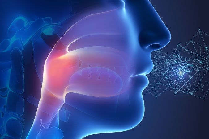 Anatomical graphic of nasopharyngeal cancer
