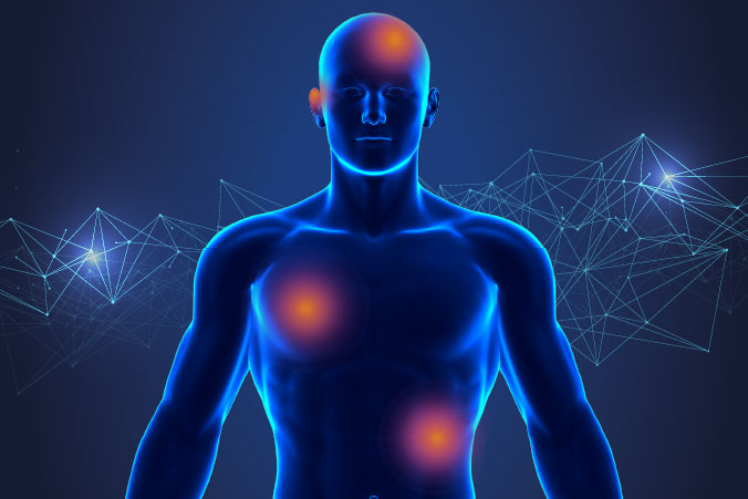 Anatomical graphic of skin cancer