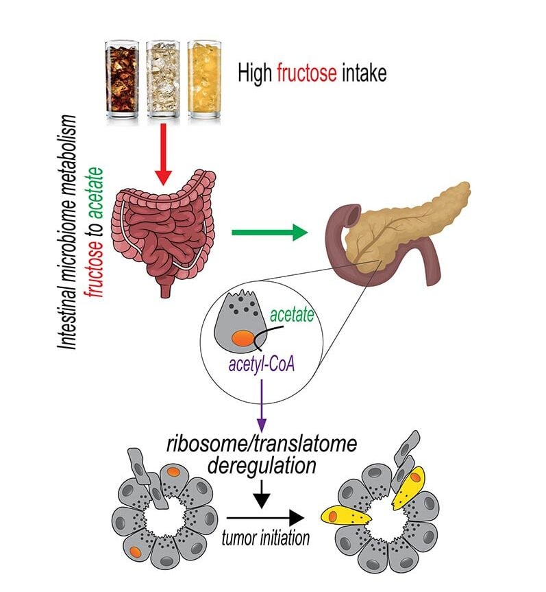 Diagram showing high fructose intake affecting intestinal metabolism, producing acetate, which travels to the pancreas. Acetate is converted to acetyl-CoA, leading to ribosome deregulation and tumour initiation.