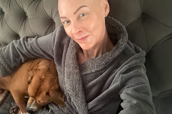 A smiling bald person in a grey dressing gown sits on a sofa, holding a brown dog that is resting comfortably on their lap.